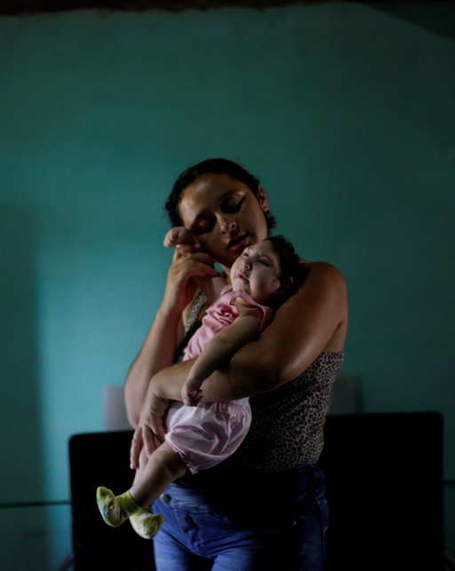 seorang ibu menggendong bayi dengan mikrosefali di brazil
